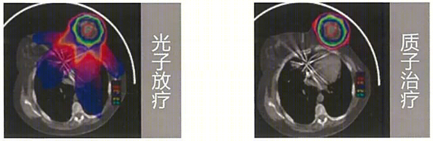 重庆全域肿瘤医院质子中心项目-5