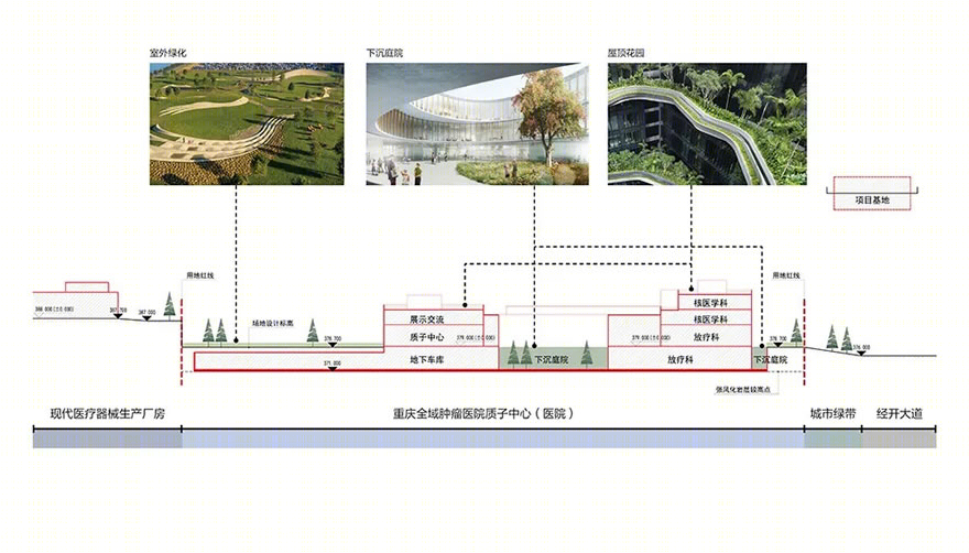 重庆全域肿瘤医院质子中心项目-42